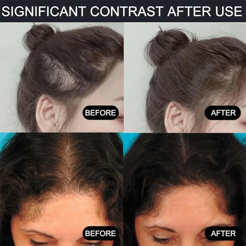 Waverloo Magic Root Cover Up - Hairline Powder Instantly Conceals Hair Loss with Puff Touch for Thin