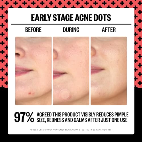 PEACE OUT Early Stage Acne Dots, Acne-Fighting Pimple Patches, Salicylic Acid Unclogs Pores and Targets Acne Blemishes, (8 Acne Dots)