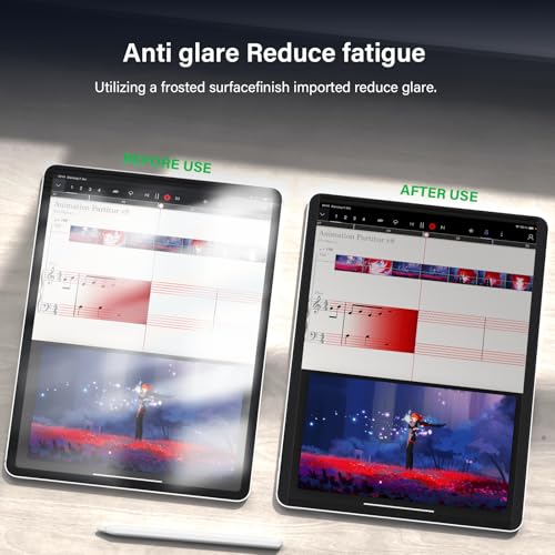 Image of Magnetic 360 Privacy Screen Protector Compatible with iPad A16 (10th /11th Generation) 10.9 /11 Inch 2022 /2025 , Anti Glare Shield Anti Blue Light Filter, Bubble-Free Film Easy Install Black Guard