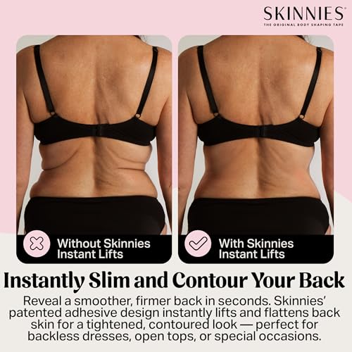 Skinnies Instant Back Lift Tape - Patented & Made in USA - Smooths Back Fat Instantly - Hides Easily on Your Sides - Waterproof, Clear Adhesive Strips, Sweatproof Body Tape for Women - 5 Pairs2