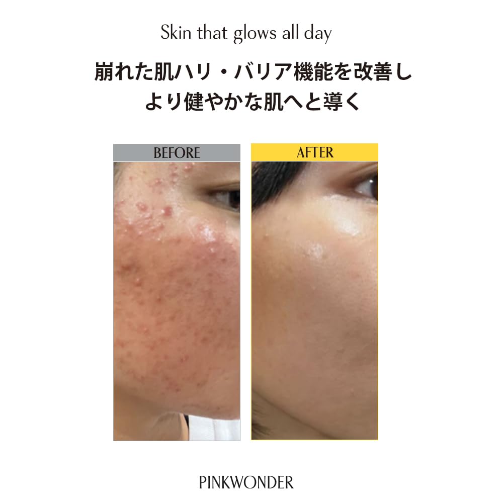 Amazon | PINKWONDER ホホバ トナー 化粧水 黄金比率7:3 保湿 弾力ケア