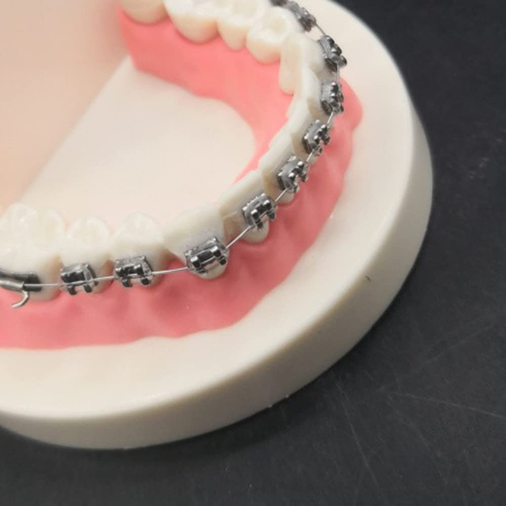 Modello di Simulazione dei Denti orali - Modello dimostrativo ortodontico Dentale - Modello di Trattamento dei Denti dentali con Attacco Metallico, Modello esplicativo dell'ar,B