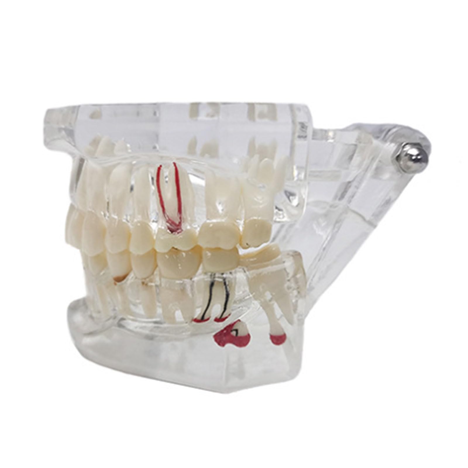 Modello Dentale Denti Impianto Restauro Ponte Insegnamento Studio Scienza Medica Malattia Dentista Odontoiatria Prodotti Regalo Dentale