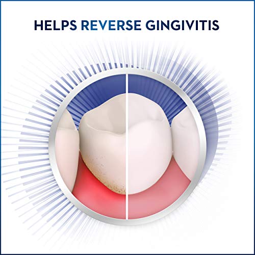 Crest Gum & Enamel Repair Toothpaste, Advanced Whitening, 4.1Oz (Pack Of 3) ( Packaging May Vary ) #TOP5