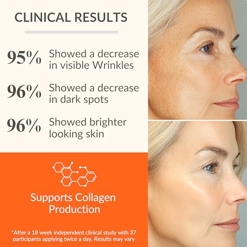 LeVaye Vitamin C Serum, Anti-Aging Face Serum – 15% Vitamin C, Ferulic Acid, Niacinamide, Hyaluronic Acid, Peptides, Ceramides – Targets Wrinkles, Fine Lines, Dark Spots, Enlarged Pores, Dry Skin - Image 3