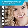 Whitebite Pro Professional Teeth Whitening Kit with Gels for Sensitive Teeth: Whitening LED Light, 35% Carbamide Peroxide Gel, Remineralization Gel (Tea Tree)