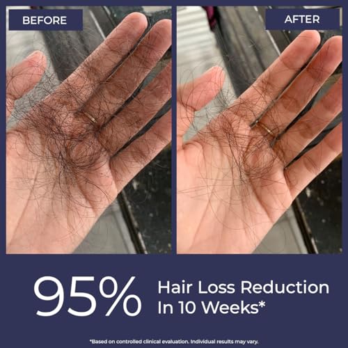 Image of Conscious Chemist Hair Growth & Anti Hair Fall Serum | Hairgenyl, 3% Redensyl, 2% Anagain, 2% Procapil, 2% Biotin & Saw palmetto | Controls Hairfall & 95% Saw New Hair Growth | Improves Hair Density | For Men & Women | 30ml