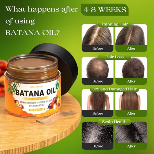 GREEONIL Raw Batana Oil with Scalp Massager Hair Brush for Hair Growth, Organic and Natural Dr Sebi Raw Batana Oil for Men Women, Prevents Hair Loss, Eliminate Frizzy, Damaged and Split Ends, 3 Pack — view 3