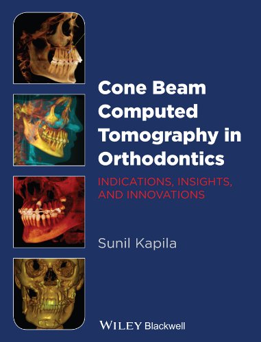 Cone Beam Computed Tomography in Orthodontics: Indications, Insights, and Innovations