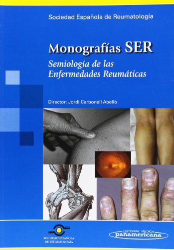 Semiologia De Las Enfermedades Reumaticas