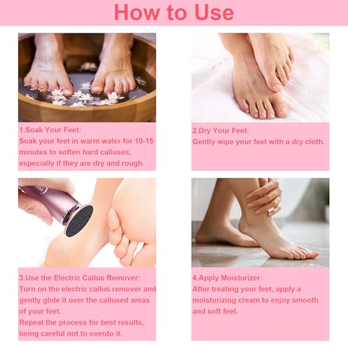 Hayzbao MJQ Electric Foot File - Callus Remover For Feet,Professional Pedicure Tool thumb #6