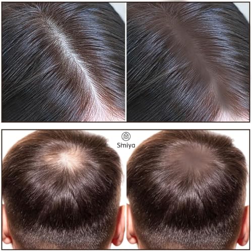 Image of SIMIYA Instant Natural Hairline Colour Touch-Up Powder for Women & Men - Black | Hair Shading Sponge Pen, Hairline Shadow Powder Stick, Quick Hair Root Touch-Up Stick (BROWN, PACK OF 2)