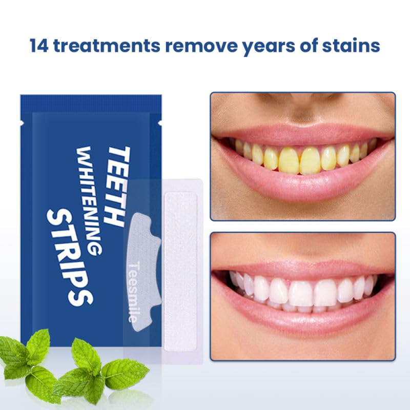 Image of Teesmile Teeth Whitening Strips Offer 21 Treatments, Gentle on Enamel and Suitable for Non-Sensitive Teeth. Safely Brighten Your Smile Without Causing harm, with a Pack containing 42 Strips