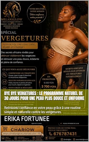  Bye bye vergetures : le programme naturel de 30 jours pour une peau plus douce et uniforme: Retrouvez confiance en votre peau grâce à une routine simple ... (GLOW UP COMPLET t. 1) (French Edition)