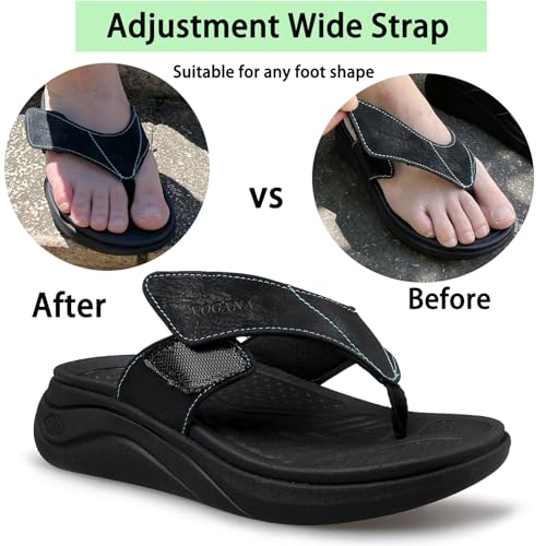 Flip Flops for Women with Adjustable Width Sandals Orthopedic for Swollen Feet | Foot Pain Relief3
