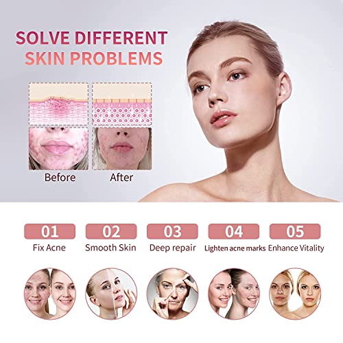 Aravli Omega PDT LED Light Therapy Facial Machine, Face Whitening, Rejuvenation Skin Care Beauty Equipment Led Facial Machine Light Therapy Beauty Device - Image 5