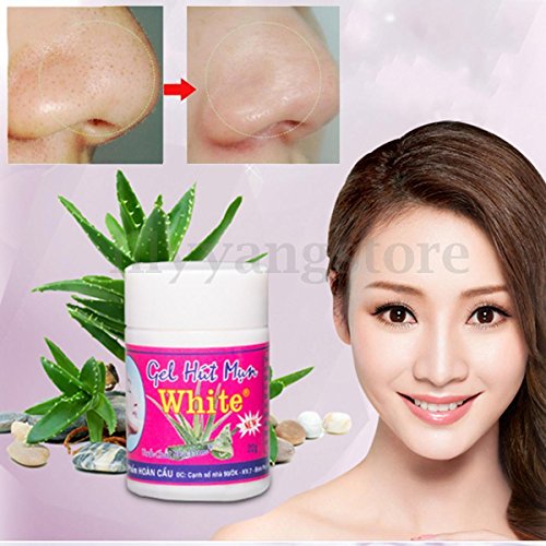 [GEL MAT NA HUT MUN] Aloe Vera Whiteheads Blackhead Removal Pore ACNE Nose