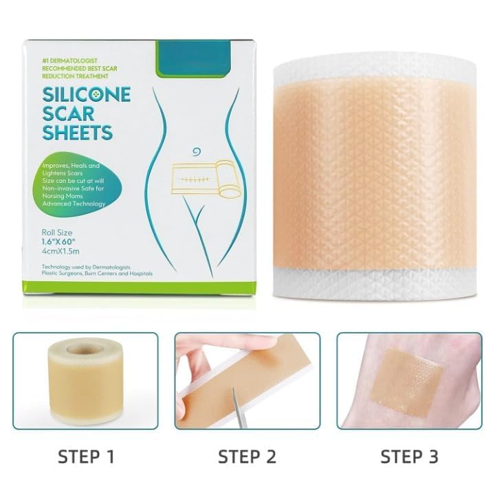 Image of Silicone Scar Removal Tape (1.5M Roll) Medical Grade Reusable Scar Reduction Sheets For Surgical, Handmade, BPA Free,C-Section, Acne, Burn & Keloid Scars Soft & Breathable Skin Tape