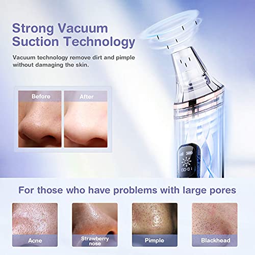 ANLAN Limpiador de Poros Limpiedor Facial Eléctrico con Luz Azul y Roja, Blackhead Remover Succionador de Puntos Negros… - Imagen 3