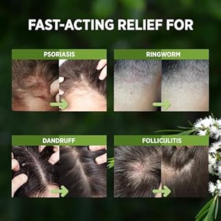 RoyceDerm Tea Tree Scalp Relief Spray: Leave-In Scalp Care for Dry, Flaky, and Itchy Scalp - Tea Tree Oil Formula for Comfort, Hydration, and Balance - Conditioning Support for Women & Men