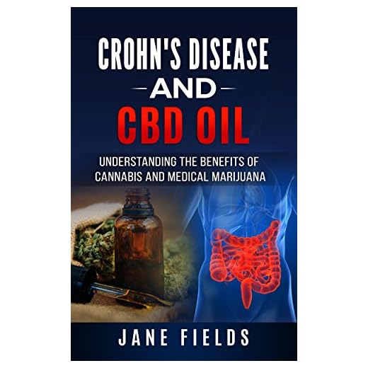 Crohn's and CBD Oil: Understanding the Benefits of Cannabis & Medical Marijuana: The natural, organic, and pharmaceutical free treatment for Crohn's Disease, IBS and Ulcerative Colitis.