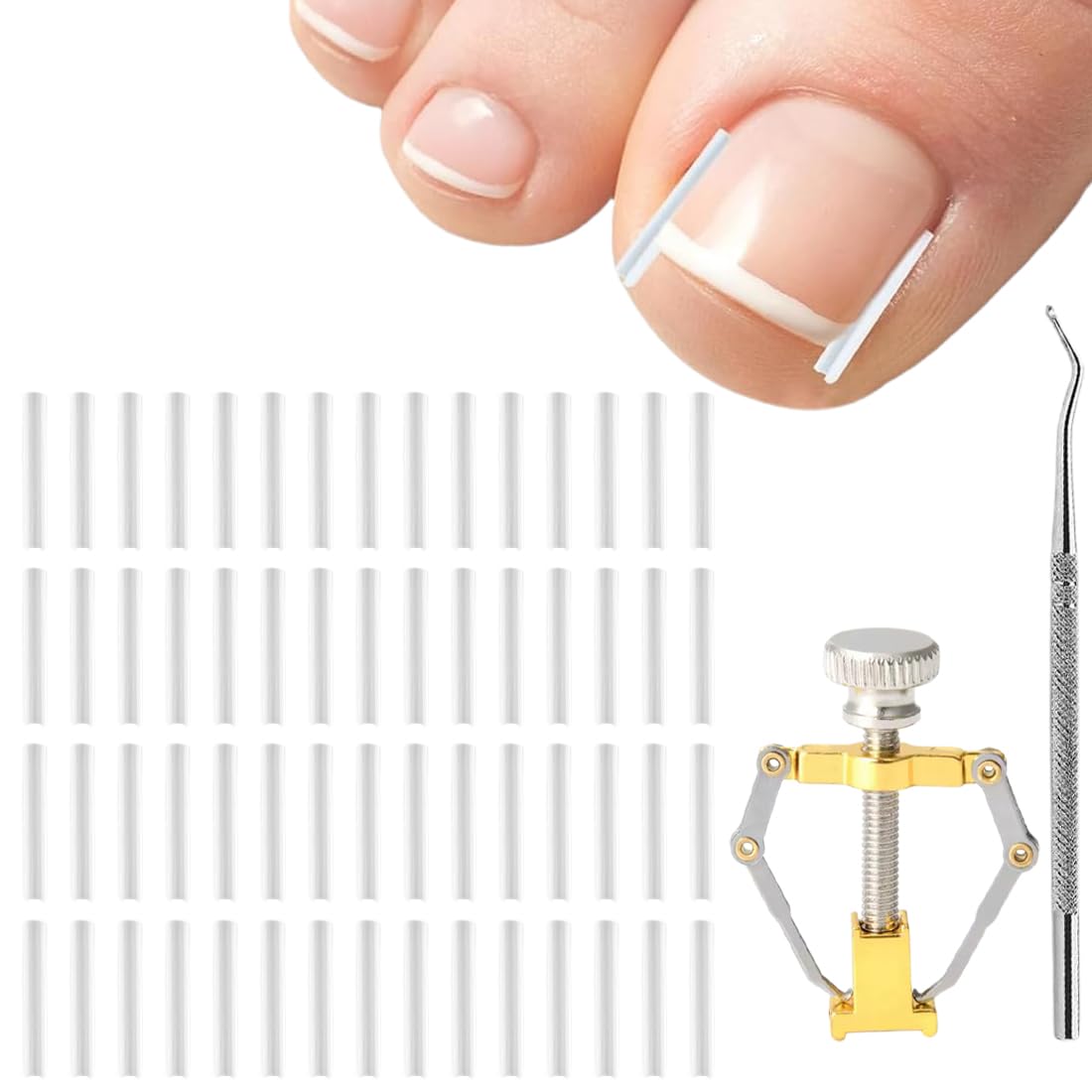 60 Pcs Set Correttore per Unghie Incarnite, Strisce Raddrizzanti per Unghie Incarnite senza Dolore con Ortesi e Solvente per Unghie, per Unghie Dolci di Unghie Set di Strumenti Semplici