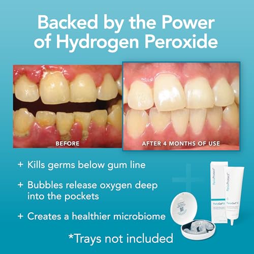 Image of PerioGelX | Periodontal Treatment for Teeth | Promotes Teeth Whitening (3 oz.)
