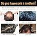 Spartan Repair Shampoo Root Activator Shampoo for Men: Hair Growth Shampoo for Hair Loss and Thinning Hair, For Anti-Hair Loss, Natural Regrowth Formula for Men and Women- 6.7 fl oz / 200 mL