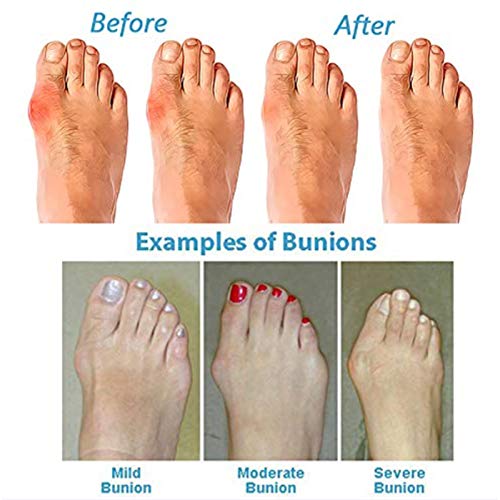 Wygwlg Women Artisanal Sandals Flip-Flops, Streetwear Fashion Shoes, for Girlfriends and Mother,354