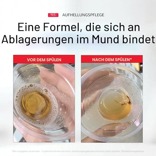 Hismile iD Stain Whitening Mundspülung – Alkoholfreie Aufhellungsspülung mit Wasserstoffperoxid & Ätherischen Ölen… – Ansicht 6