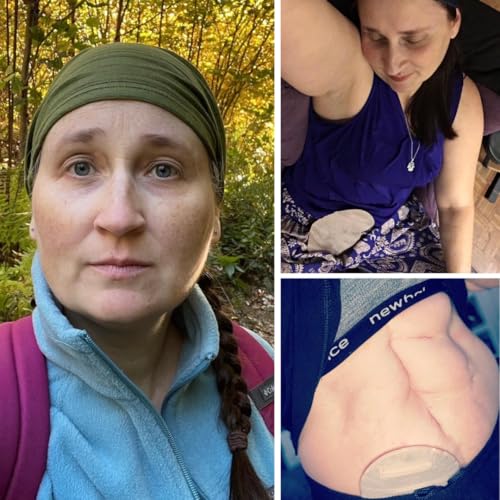 Episode 22: Katie Vyn, Ulcerative Colitis and the Beautiful Journey of Life cover art