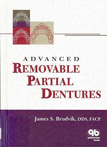 Advanced Removable Partial Dentures view 2
