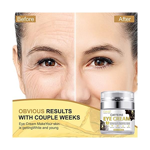 Caffeine-Eye-Cream-Anti-Wrinkle-Eye-Cream-for-Dark-Circles-and-Puffiness-with-Collagen-Puffiness-WrinklesCrows-Feet-Eye-Lift-Treatment-For-Men-Women ELBBUB Caffeine Eye Cream, Anti Wrinkle Eye Cream and Puffiness-with Collagen, Puffiness, Wrinkles,Crows Feet Eye Lift Treatment For Men & Women