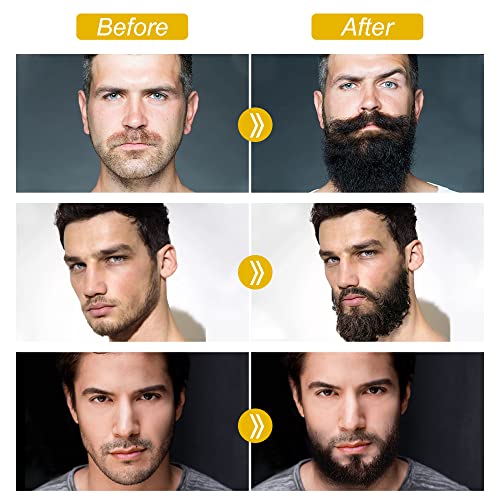 The 26 Best Beard Growth Kits of 2025 [Verified] - Cherry Picks