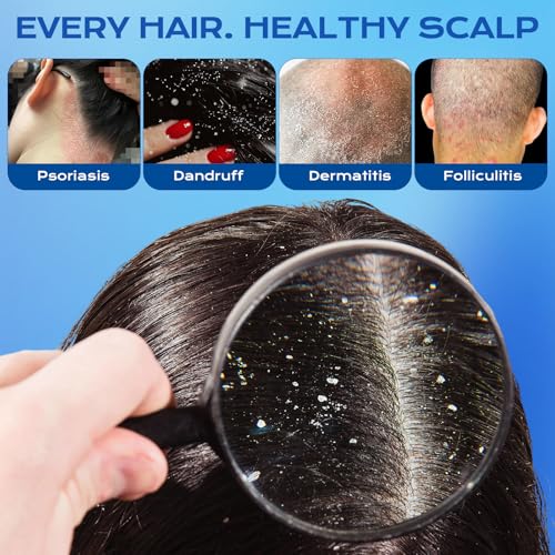 FYZMTL 1% Ketoconazole Anti-Dandruff Shampoo - Image 2
