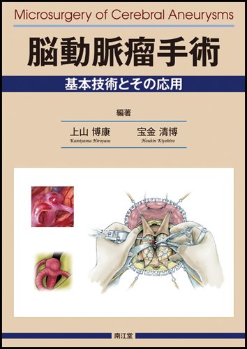 脳動脈瘤手術　基本手術とその応用　上山博康 51LCM1GcKxL.jpg