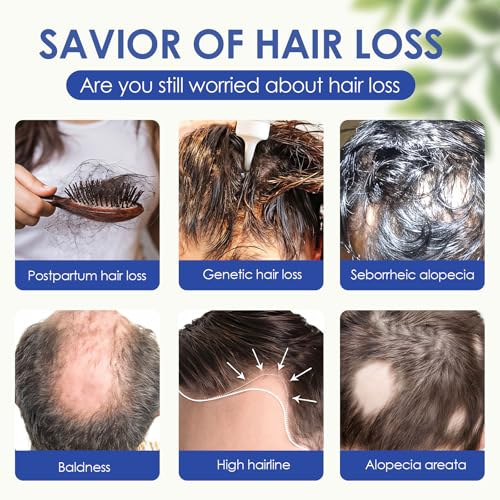 60Ml Spray Per La Crescita Dei Capelli,Spray Per Adatto Addensare Capelli,Ridotta Anti-Caduta Capelli Per Donna E Uomo - 6