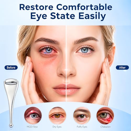 OGRFNS Metal Eye Roller for Puffy Eyes & Dry Eye Relief - Manual Warm & Cold Eyelid Massager for Stye, Chalazion & MGD Support, Meibomian Gland Compress for Meibum Flow & Eye Relaxation — view 2