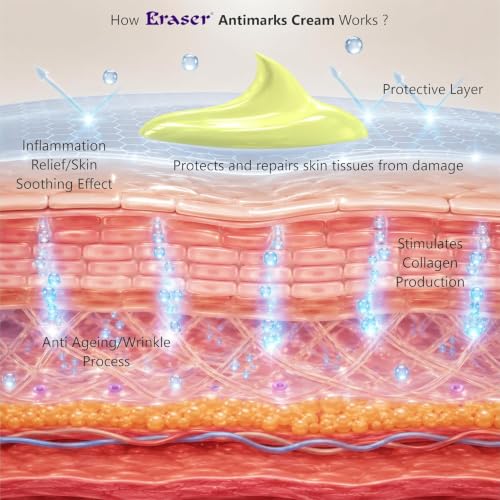 Image of Eraser Ayurvedic Anti Marks & Dark Spots Removal Cream - Unisex (25g*6) | with Wheat Germ Oil, Haldi, Neem, Rose, Kesar | Dark Circle | Pregnancy Delivery Marks | Pigmentation, Wrinkles, Blemishes