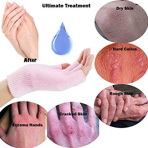 Codream Moisturizing Gel Heel Sleeves and Gloves, Gel SPA Gloves Socks Repair Cracked Skin and Exfoliate Skin,Soften Beauty Hands and Feet for Women