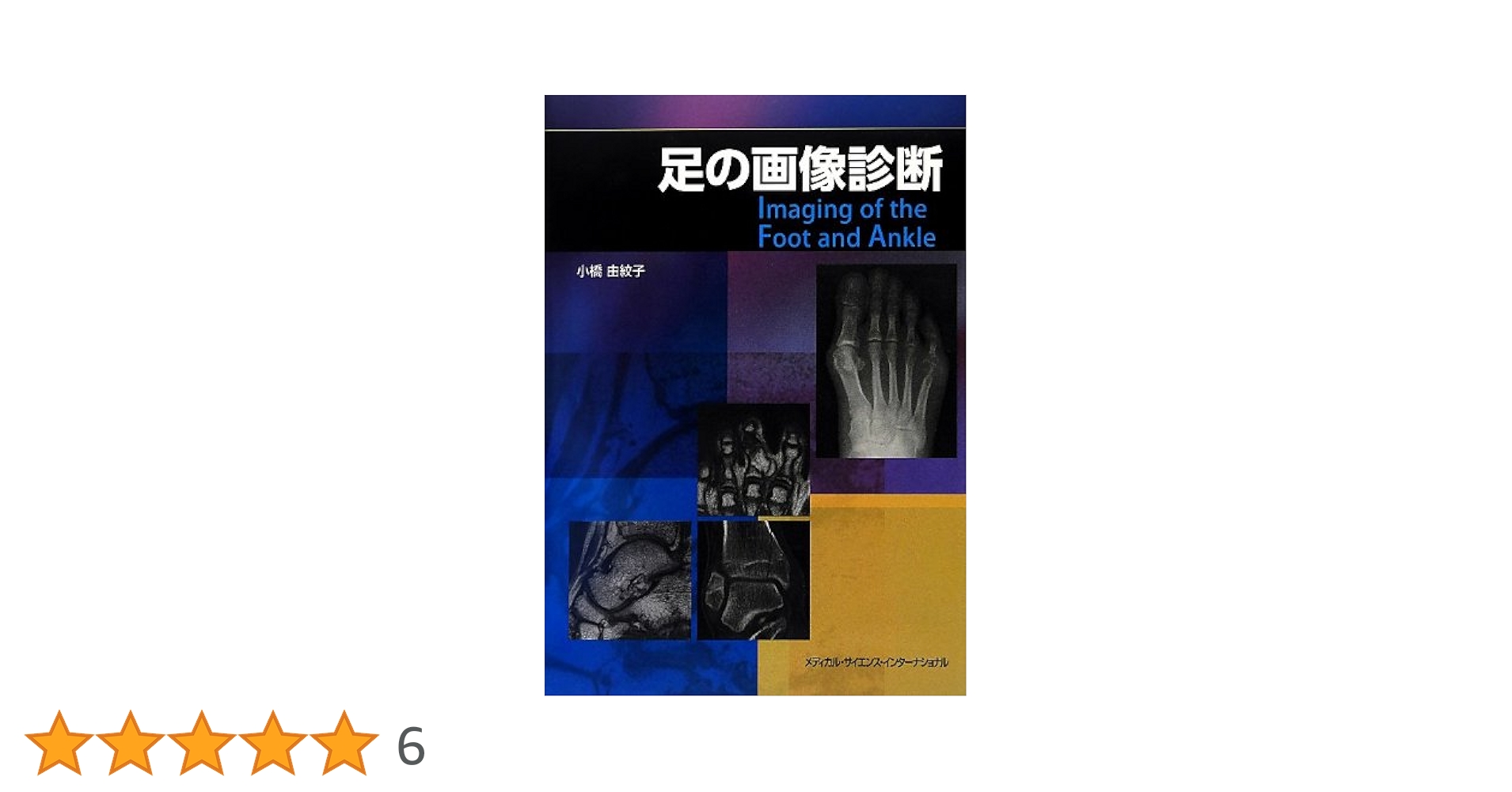 足の画像診断 [単行本] 小橋由紋子 足の画像診断 第2版 | 小橋由紋子 |本 | 通販 | Amazon