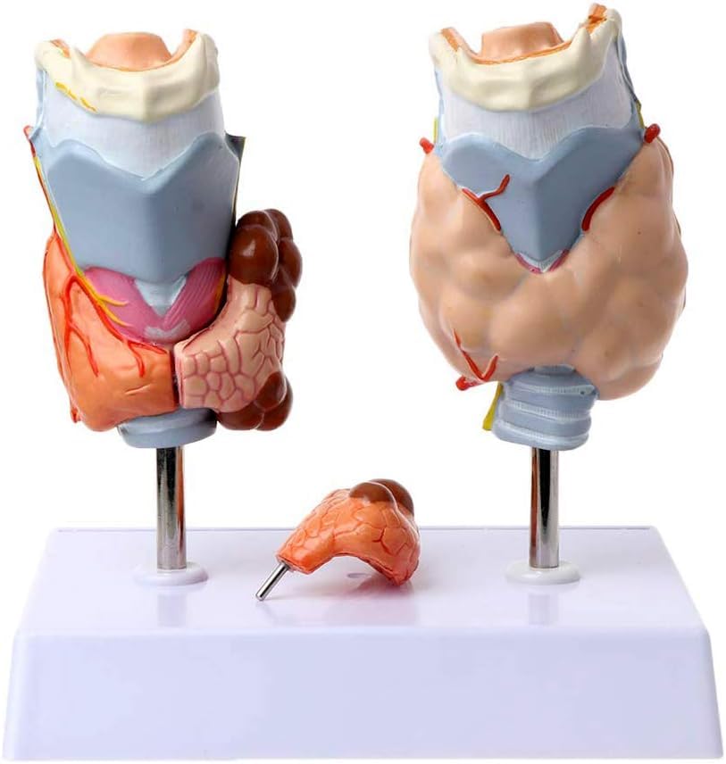 CLCulture Anatomy Model Skeleton Model Thyroid Pathology Model Thyroid Model Throat Model Thyroid Disease Model,Endokrinerkrankung – für medizinisches Lehr-Spielzeug