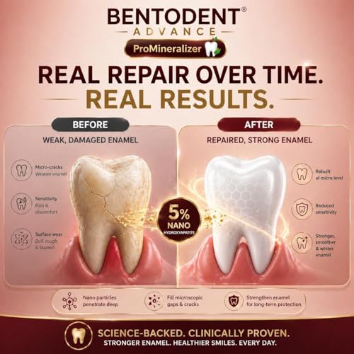 Image of Bentodent Advanced Toothpaste Promineraliser with 5% Nano Hydroxyapatite, Enamel Repair & Sensitivity Protection, Fluoride & SLS-Free, Licorice Mint Toothpaste for Strong Teeth & Fresh Breath,100g