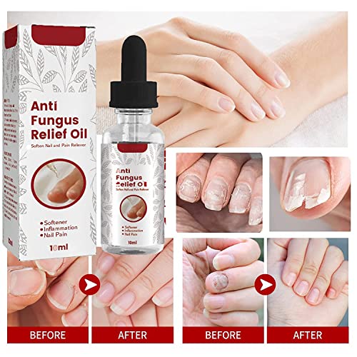 Kerassentials For Toenail Fungus, Anti Fungus Relief Oil,Onychomycosis Nail,Strong Nails (3Pcs) #TOP4