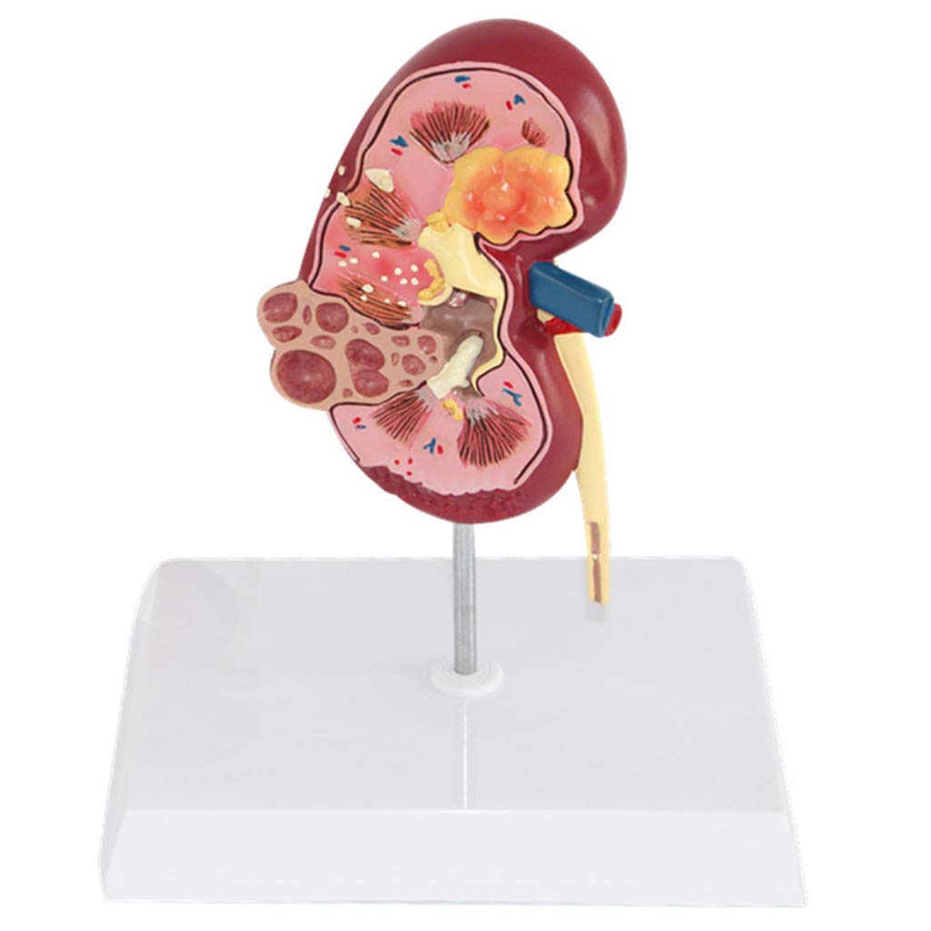 Modelli Scientifici di Anatomia Umana - Modello Anatomico del Rene Umano - Modello Educativo Medico in Materiale PVC - per L'Aiuto alla Formazione degli Studenti della Scuola di Medicina