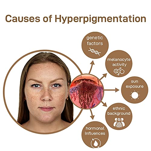 Lypocs Gfouk Anti-Pigment Probiotic Spf 50 Day Care Cream,Anti-Pigment Face Day Cream,Dark Spot Corrector Daily Face Serum, Dark Spot Remover For All Skin Types-50Ml (2Pcs) #TOP5