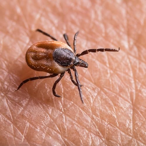 『Why is ‘chronic’ lyme disease so controversial?』のカバーアート