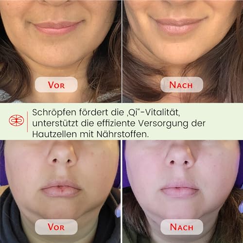 Rena Chris Gesichts-Schröpfen Set & Gua Sha Werkzeug - Silikon Schröpfgläser & Jade Gua Sha Stein für natürliche Hautpflege und Lippenaufpolsterung (Grün) 3