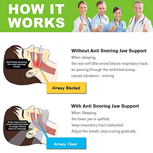Anti Snoring Chin Straps, Anti Snoring Devices, Ajustable Stop Snoring Solution Snore Reduction Sleep Aids, Snore Stopper Chin Straps Snore Relief for Men Women Snoring Sleeping Mouth Breather