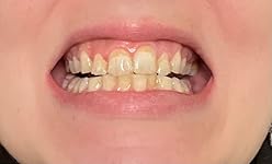 Review Image by Amazon Customer Amazon Customer